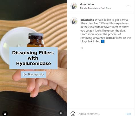 To find out more about <strong>hyaluronidase</strong> treatments and to reverse unwanted dermal <strong>filler</strong> treatments, please contact the office of Dr. . How to dissolve filler without hyaluronidase reddit
